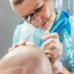 Empowering Artists: The Importance of Accredited Scalp Micropigmentation Training