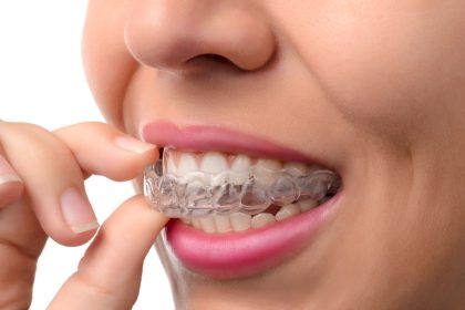 The Art of Aesthetic Dentistry Exploring Veneers in the Heart of Turkey