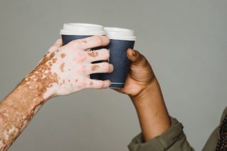 The Impact of Vitamin C Face Cream on Hyperpigmentation and Skin Tone