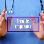 5 Factors Affecting The Real Cost of Penile Implant Surgery