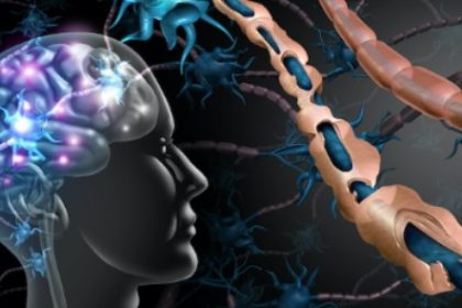 Multiple Sclerosis Treatments in Florida