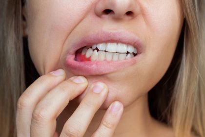 Preventing Gum Disease: Tips for Maintaining Gum Health