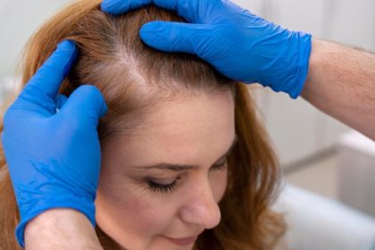 How to Stop Crown Hair Thinning: Effective Solutions and Treatments