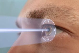 Considering LASIK? Here's Everything You Need to Know